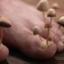 How to Know If Your Toenail Fungus Is Dying